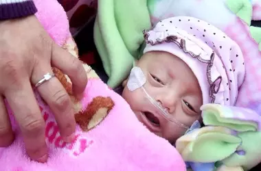 The Amazing Resilience of Premature Babies: Stories of Survival and Hope